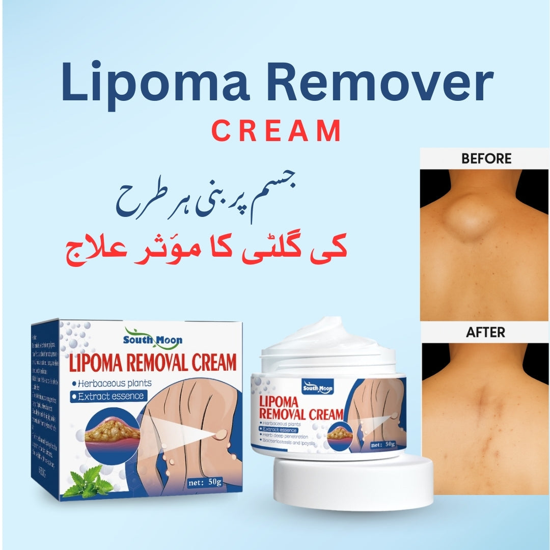 South Moon Lipoma Removal Cream
